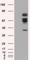 XRCC1 Antibody - HEK293T cells were transfected with the pCMV6-ENTRY control (Left lane) or pCMV6-ENTRY XRCC1 (Right lane) cDNA for 48 hrs and lysed. Equivalent amounts of cell lysates (5 ug per lane) were separated by SDS-PAGE and immunoblotted with anti-XRCC1.