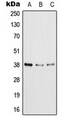 XRCC4 Antibody - Western blot analysis of XRCC4 expression in HeLa (A); MCF7 (B); NIH3T3 (C) whole cell lysates.