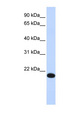 YAF2 Antibody - YAF2 antibody Western blot of Fetal liver lysate. This image was taken for the unconjugated form of this product. Other forms have not been tested.