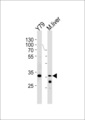YBX3 / CSDA Antibody - CSDA Antibody western blot of Y79 cell line and mouse liver lysates (35 ug/lane). The CSDA antibody detected the CSDA protein (arrow).