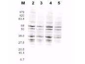 Yeast Rfa2 Antibody - Anti-RFA2 Antibody - Western Blot. This product was assayed by western blotting against RFA2 containing cell lysates. Blot incubated for 1 hr at RT with affinity purified Rabbit anti-RFA2 pan reactive Lot 13229 at 1.0 ug/ml followed by 1:5000 dilution of IRDye800 Sheep anti-Rabbit IgG for 1 hr at RT.