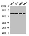 YedQ Antibody - Western Blot Positive WB detected in:Rosseta bacteria lysate at 80 ug, 40 ug, 20 ug, 10 ug All Lanes: yedQ antibody at 2.5µg/ml Secondary Goat polyclonal to rabbit IgG at 1/50000 dilution Predicted band size: 65 kDa Observed band size: 65 kDa