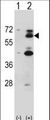 YES1 / c-Yes Antibody - Western blot of Yes1 (arrow) using rabbit polyclonal Mouse Yes1 Antibody. 293 cell lysates (2 ug/lane) either nontransfected (Lane 1) or transiently transfected (Lane 2) with the Yes1 gene.