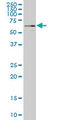 YES1 / c-Yes Antibody - YES1 monoclonal antibody (M03), clone 2D5 Western blot of YES1 expression in A-431.