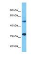 YIF1A Antibody - Western blot of YIF1A Antibody with human Fetal Liver lysate.  This image was taken for the unconjugated form of this product. Other forms have not been tested.