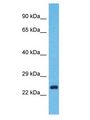 YIPF7 Antibody - YIPF7 antibody Western Blot of HepG2. Antibody dilution: 1 ug/ml.  This image was taken for the unconjugated form of this product. Other forms have not been tested.