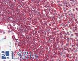 YKL39 / CHI3L2 Antibody - Human Spleen: Formalin-Fixed, Paraffin-Embedded (FFPE)