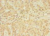YKT6 Antibody - Immunohistochemistry of paraffin-embedded human adrenal gland tissue using antibody at dilution of 1:100.