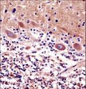 Yo / CDR2 Antibody - CDR2 Antibody immunohistochemistry of formalin-fixed and paraffin-embedded human cerebellum tissue followed by peroxidase-conjugated secondary antibody and DAB staining.