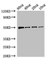 yopM Antibody - Western Blot Positive WB detected in Recombinant protein All Lanes:yopM antibody at 2µg/ml Secondary Goat polyclonal to rabbit IgG at 1/50000 dilution Predicted band size: 50 kDa Observed band size: 50 kDa