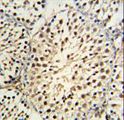 YPEL5 Antibody - YPEL5 Antibody IHC of formalin-fixed and paraffin-embedded mouse testis tissue followed by peroxidase-conjugated secondary antibody and DAB staining.
