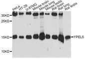 YPEL5 Antibody - Western blot analysis of extracts of various cell lines, using YPEL5 antibody at 1:3000 dilution. The secondary antibody used was an HRP Goat Anti-Rabbit IgG (H+L) at 1:10000 dilution. Lysates were loaded 25ug per lane and 3% nonfat dry milk in TBST was used for blocking. An ECL Kit was used for detection and the exposure time was 90s.