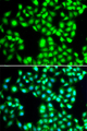 YTHDC1 Antibody - Immunofluorescence analysis of MCF7 cells.