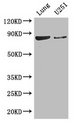 YTHDC1 Antibody - Positive WB detected in:Mouse lung tissue,U251 whole cell lysate;All lanes: YTHDC1 antibody at 3.4ug/ml;Secondary;Goat polyclonal to rabbit IgG at 1/50000 dilution;Predicted band size: 85,83 kDa;Observed band size: 85 kDa;
