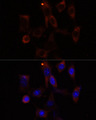 YTHDC2 Antibody - Immunofluorescence analysis of NIH/3T3 cells using YTHDC2 antibody at dilution of 1:100. Blue: DAPI for nuclear staining.