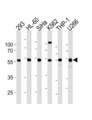 YY1 Antibody - YY1 Antibody (L89) western blot of 293,HL-60,SiHa,K562,THP-1,U266 cell line lysates (35 ug/lane). The YY1 antibody detected the YY1 protein (arrow).