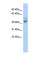ZACN Antibody - ZACN / LGICZ1 antibody Western blot of NCI-H226 cell lysate. This image was taken for the unconjugated form of this product. Other forms have not been tested.