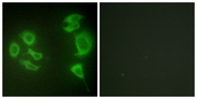 ZAK / MLTK Antibody - Immunofluorescence analysis of HepG2 cells, using MLTK Antibody. The picture on the right is blocked with the synthesized peptide.