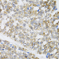 ZAK / MLTK Antibody - Immunohistochemistry of paraffin-embedded mouse esophageal cancer tissue.