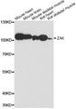ZAK / MLTK Antibody - Western blot analysis of extracts of various cell lines, using ZAK antibody at 1:3000 dilution. The secondary antibody used was an HRP Goat Anti-Rabbit IgG (H+L) at 1:10000 dilution. Lysates were loaded 25ug per lane and 3% nonfat dry milk in TBST was used for blocking. An ECL Kit was used for detection and the exposure time was 90s.