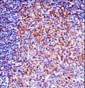 ZAP70 Antibody - ZAP70 Antibody immunohistochemistry of formalin-fixed and paraffin-embedded human tonsil tissue followed by peroxidase-conjugated secondary antibody and DAB staining.