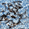 ZAP70 Antibody - Immunohistochemical analysis of ZAP70 (pY319) staining in human tonsil formalin fixed paraffin embedded tissue section. The section was pre-treated using heat mediated antigen retrieval with sodium citrate buffer (pH 6.0). The section was then incubated with the antibody at room temperature and detected using an HRP polymer system. DAB was used as the chromogen. The section was then counterstained with hematoxylin and mounted with DPX.