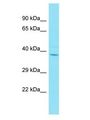 ZAR1L Antibody - ZAR1L antibody Western Blot of HT1080. Antibody dilution: 1 ug/ml.  This image was taken for the unconjugated form of this product. Other forms have not been tested.