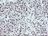 ZBED1 / TRAMP Antibody - IHC of paraffin-embedded Human pancreas tissue using anti-ZBED1 mouse monoclonal antibody. (Heat-induced epitope retrieval by 10mM citric buffer, pH6.0, 100C for 10min).