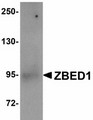 ZBED1 / TRAMP Antibody - Western blot of ZBED1 in A549 cell lysate with ZBED1 antibody at 1 ug/ml.