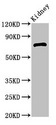 ZBTB16 / PLZF Antibody - Western Blot Positive WB detected in:Mouse kidney tissue All Lanes:ZBTB16 antibody at 2.5µg/ml Secondary Goat polyclonal to rabbit IgG at 1/50000 dilution Predicted band size: 75,62 KDa Observed band size: 75 KDa