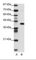 ZBTB25 Antibody - A: Marker, B: Transfected 293T Cell Lysate.  This image was taken for the unconjugated form of this product. Other forms have not been tested.