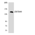 ZBTB40 Antibody - Western blot analysis of the lysates from HUVECcells using ZBTB40 antibody.