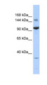 ZBTB40 Antibody - ZBTB40 antibody Western blot of 721_B cell lysate. This image was taken for the unconjugated form of this product. Other forms have not been tested.