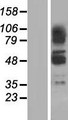 ZBTB43 Protein - Western validation with an anti-DDK antibody * L: Control HEK293 lysate R: Over-expression lysate