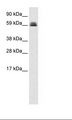 ZBTB45 Antibody - Fetal Lung Lysate.  This image was taken for the unconjugated form of this product. Other forms have not been tested.