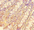 ZBTB46 Antibody - Immunohistochemistry of paraffin-embedded human rectum tissue at dilution of 1:100