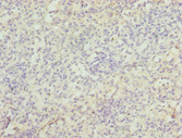 ZBTB48 / HKR3 Antibody - Immunohistochemistry of paraffin-embedded human spleen tissue at dilution 1:100