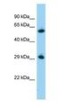 ZBTB7A / Pokemon Antibody - ZBTB7A / Pokemon antibody Western Blot of Mouse Pancreas.  This image was taken for the unconjugated form of this product. Other forms have not been tested.