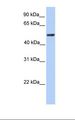 ZBTB9 Antibody - Transfected 293T cell lysate. Antibody concentration: 1.0 ug/ml. Gel concentration: 12%.  This image was taken for the unconjugated form of this product. Other forms have not been tested.