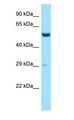 ZC3H10 Antibody - ZC3H10 antibody Western Blot of Mouse Liver.  This image was taken for the unconjugated form of this product. Other forms have not been tested.