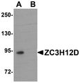 ZC3H12D Antibody - Western blot analysis of ZC3H12D in THP-1 cell lysate with ZC3H12D antibody at 1 ug/ml in (A) the absence and (B) the presence of blocking peptide.