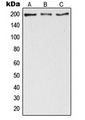 ZC3H13 Antibody - Western blot analysis of ZC3H13 expression in HeLa (A); NIH3T3 (B); PC12 (C) whole cell lysates.
