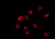 ZC3H13 Antibody - Staining HeLa cells by IF/ICC. The samples were fixed with PFA and permeabilized in 0.1% Triton X-100, then blocked in 10% serum for 45 min at 25°C. The primary antibody was diluted at 1:200 and incubated with the sample for 1 hour at 37°C. An Alexa Fluor 594 conjugated goat anti-rabbit IgG (H+L) Ab, diluted at 1/600, was used as the secondary antibody.