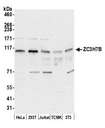 ZC3H7B Antibody - Detection of human and mouse ZC3H7B by western blot. Samples: Whole cell lysate (15 µg) from HeLa, HEK293T, Jurkat, mouse TCMK-1, and mouse NIH 3T3 cells prepared using NETN lysis buffer. Antibody: Affinity purified rabbit anti-ZC3H7B antibody used for WB at 0.04 µg/ml. Detection: Chemiluminescence with an exposure time of 30 seconds.