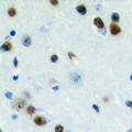 ZC3H7B Antibody - Immunohistochemical analysis of ZC3H7B staining in human brain formalin fixed paraffin embedded tissue section. The section was pre-treated using heat mediated antigen retrieval with sodium citrate buffer (pH 6.0). The section was then incubated with the antibody at room temperature and detected with HRP and DAB as chromogen. The section was then counterstained with hematoxylin and mounted with DPX.