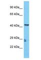 ZCCHC18 Antibody - ZCCHC18 antibody Western Blot of HCT15. Antibody dilution: 1 ug/ml.  This image was taken for the unconjugated form of this product. Other forms have not been tested.