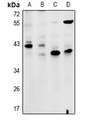 ZDHHC15 Antibody - Western blot analysis of ZDHHC15 expression in HEK293T (A), HepG2 (B), AML12 (C), C6 (D) whole cell lysates.