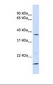 ZDHHC19 Antibody - MCF7 cell lysate. Antibody concentration: 1.0 ug/ml. Gel concentration: 12%.  This image was taken for the unconjugated form of this product. Other forms have not been tested.
