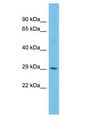 ZDHHC22 Antibody - ZDHHC22 antibody Western Blot of 293T. Antibody dilution: 1 ug/ml.  This image was taken for the unconjugated form of this product. Other forms have not been tested.