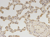 ZEB1 / AREB6 Antibody - Immunohistochemistry of paraffin-embedded rat lung using ZEB1 antibody at dilution of 1:100 (400x lens).